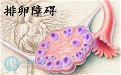 科学试管助孕帮您解决排卵障碍致不孕问题