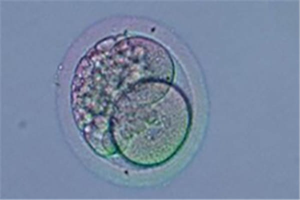 排卵障碍还能怀孕生小孩吗？我们该如何预防排卵异常？